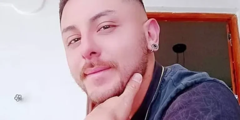 Murió Santiago Molina, el argentino que contrajo viruela del mono en México